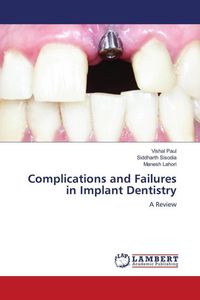 Produktbild: Complications and Failures in Implant Dentistry