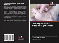 Produktbild: Coinvolgimento del piede nella gonartrosi