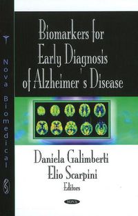 Produktbild: Biomarkers for Early Diagnosis of Alzheimer's Disease
