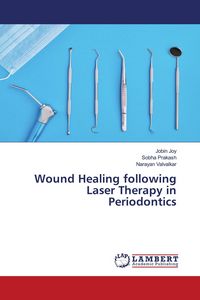 Produktbild: Wound Healing following Laser Therapy in Periodontics