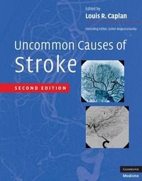 Produktbild: Uncommon Causes of Stroke
