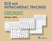 Produktbild: ECG and Intracardiac Tracings