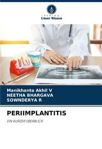 Produktbild: Periimplantitis