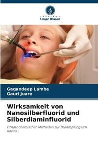 Produktbild: Wirksamkeit von Nanosilberfluorid und Silberdiaminfluorid