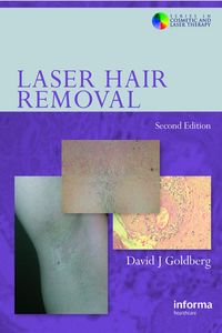 Produktbild: Laser Hair Removal