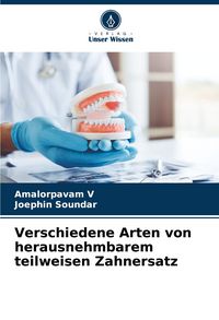 Produktbild: Verschiedene Arten von herausnehmbarem teilweisen Zahnersatz