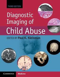 Produktbild: Diagnostic Imaging of Child Abuse