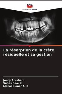Produktbild: La r&eacute;sorption de la cr&ecirc;te r&eacute;siduelle et sa gestion