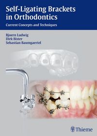 Produktbild: Self-Ligating Brackets in Orthodontics
