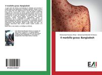 Produktbild: Il morbillo grava: Bangladesh