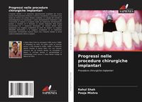 Produktbild: Progressi nelle procedure chirurgiche implantari