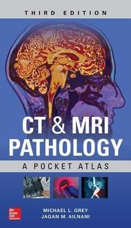 Produktbild: CT & MRI Pathology: A Pocket Atlas, Third Edition
