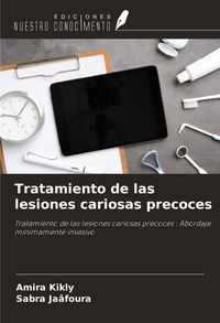 Produktbild: Tratamiento de las lesiones cariosas precoces