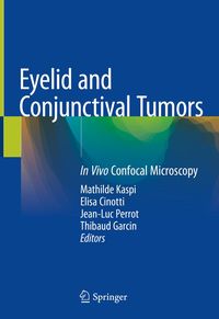 Produktbild: Eyelid and Conjunctival Tumors