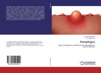 Produktbild: Pemphigus