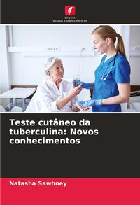 Produktbild: Teste cut&acirc;neo da tuberculina: Novos conhecimentos