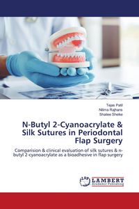 Produktbild: N-Butyl 2-Cyanoacrylate & Silk Sutures in Periodontal Flap Surgery
