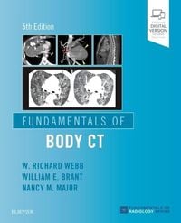 Produktbild: Fundamentals of Body CT