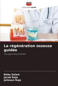 Produktbild: La r&eacute;g&eacute;n&eacute;ration osseuse guid&eacute;e