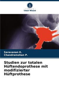 Produktbild: Studien zur totalen H&uuml;ftendoprothese mit modifizierter H&uuml;ftprothese