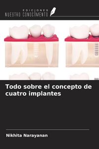 Produktbild: Todo sobre el concepto de cuatro implantes