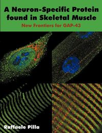 Produktbild: A Neuron-Specific Protein found in Skeletal Muscle