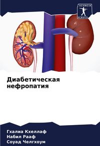 Produktbild: Diabeticheskaq nefropatiq