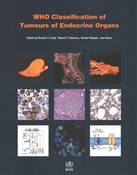 Produktbild: Who Classification of Tumours Editorial Board: Who Classific