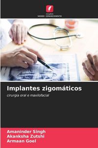 Produktbild: Implantes zigom&aacute;ticos