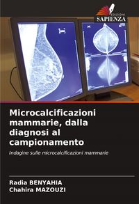 Produktbild: Microcalcificazioni mammarie, dalla diagnosi al campionamento