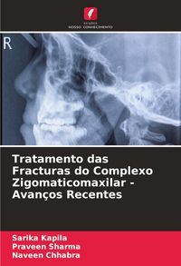 Produktbild: Tratamento das Fracturas do Complexo Zigomaticomaxilar - Avan&ccedil;os Recentes
