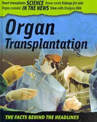 Produktbild: Organ Transplantation