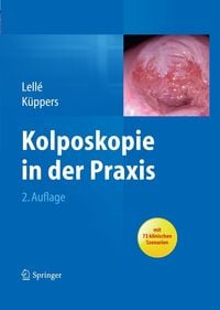 Produktbild: Kolposkopie in der Praxis