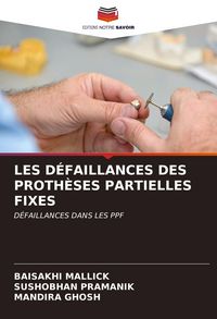 Produktbild: LES D&Eacute;FAILLANCES DES PROTH&Egrave;SES PARTIELLES FIXES