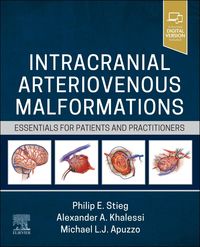 Produktbild: Intracranial Arteriovenous Malformations