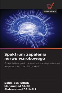 Produktbild: Spektrum zapalenia nerwu wzrokowego