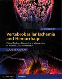 Produktbild: Vertebrobasilar Ischemia and Hemorrhage