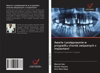 Produktbild: Awarie i post&iquest;powanie w przypadku chor&oacute;b zwi&iquest;zanych z implantami