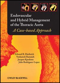 Produktbild: Endovascular and Hybrid Management of the Thoracic Aorta