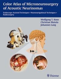 Produktbild: Color Atlas of Microsurgery of Acoustic Neurinomas