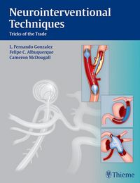 Produktbild: Neurointerventional Techniques