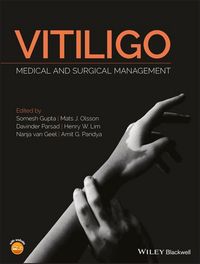Produktbild: Vitiligo