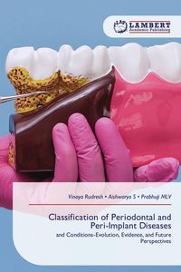 Produktbild: Classification of Periodontal and Peri-Implant Diseases