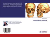 Produktbild: Mandibular Fracture