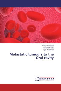 Produktbild: Metastatic tumours to the Oral cavity
