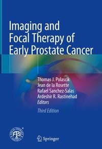 Produktbild: Imaging and Focal Therapy of Early Prostate Cancer