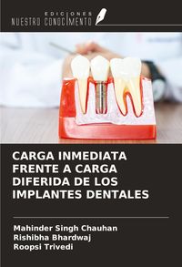 Produktbild: Carga Inmediata Frente a Carga Diferida De Los Implantes Dentales