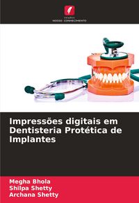 Produktbild: Impress&otilde;es digitais em Dentisteria Prot&eacute;tica de Implantes