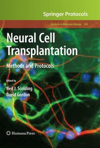 Produktbild: Neural Cell Transplantation