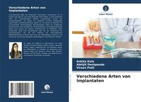 Produktbild: Verschiedene Arten von Implantaten